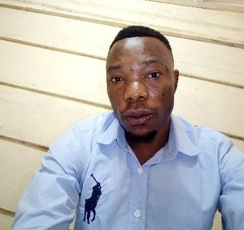 Sud-Kivu : un cas suspect de MPOX signalé dans la zone de santé de katana