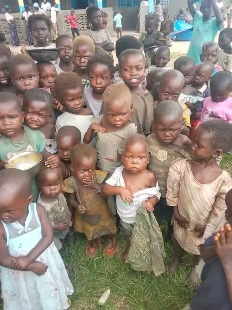 Sud-Kivu : à Kalehe, la malnutrition et les maladies menacent les sinistrés et réfugiés de Bushushu et Nyamukubi