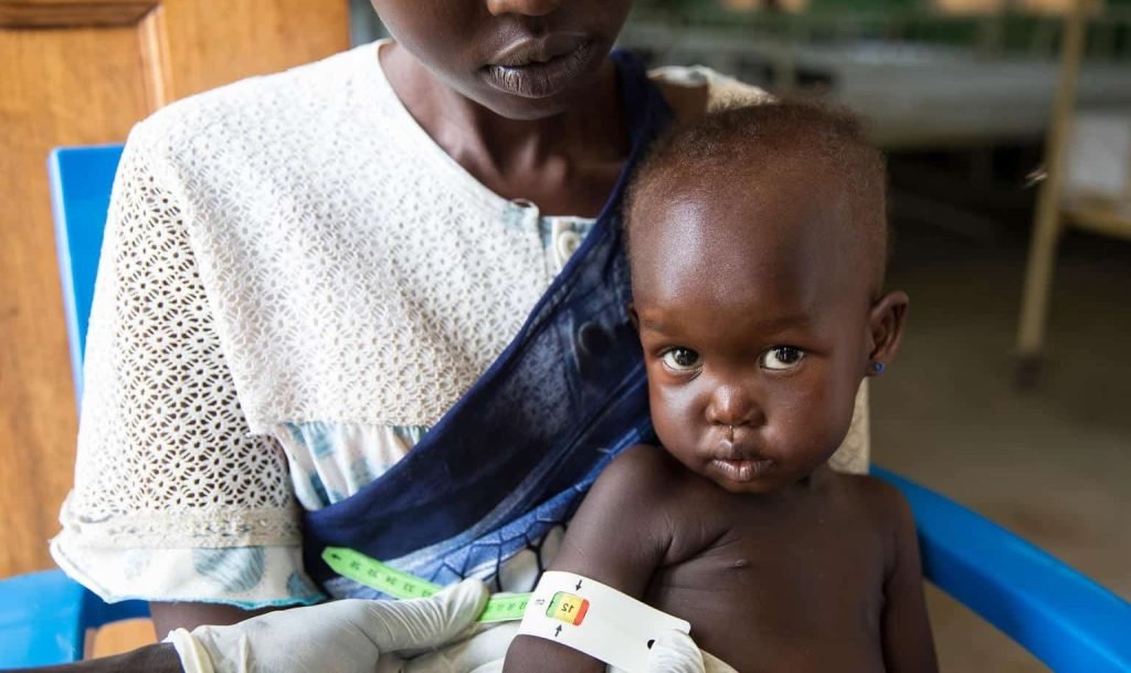 Kalehe : 40 cas de malnutrition enregistrés dans l’aire de santé de Kishinji en juillet