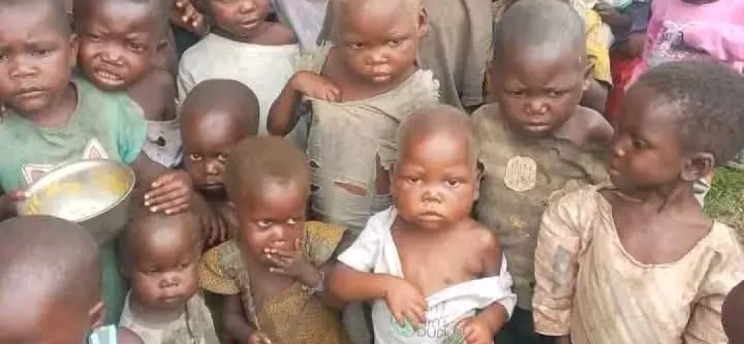 Sud-Kivu : la malnutrition infantile atteint un niveau préoccupant à Kiliba, les professionnels de santé lancent un appel à une réponse urgente